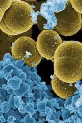 Drug-resistant MRSA carries a toxin that can cause serious illness in healthy people, including flesh-eating pneumonia, and death.