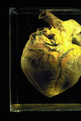 Phar Lap's heart, stored at the Institute of Anatomy in Canberra.