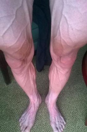 The striking image of Polish cyclist Bartosz Huzarski's legs.