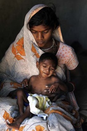 The other face of India &#8230; Ujala, 3&#189; , sits in the arms of her mother, Geeta.