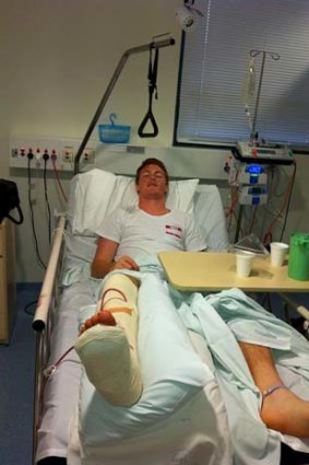 Gary Rohan was taken to hospital after breaking his leg, as this picture from Twitter shows.