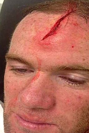 Wayne Rooney in the image he posted of his head wound.