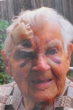 The injured 91-year-old.