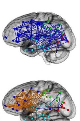 Connectome maps show the difference between the male (blue) and female brain.