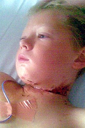 Brandon Taylor at the Mater Children's Hospital in January with a severe laceration to his throat.