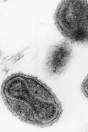 A micrograph of the smallpox virus.