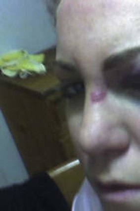 "There's no authority" … Julie-Anne Gill was brutally bashed by a gang of five girls in Casino, NSW, in 2008.