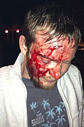 The Seabellies bass player Eddie Garven needed stitches after an attack in Brunswick Street on Saturday night.