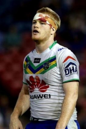 Head-knock: Raiders back-rower Joel Edwards has been named for this weekend's clash with Penrith.