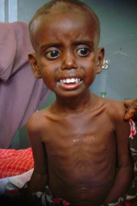 Warning that famine could spread ... a Somali child is admitted at southern Mogadishu's Banadir hospital.