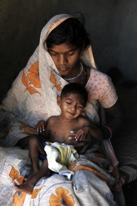 Ujala now, and her mother Geeta. She remains undernourished.