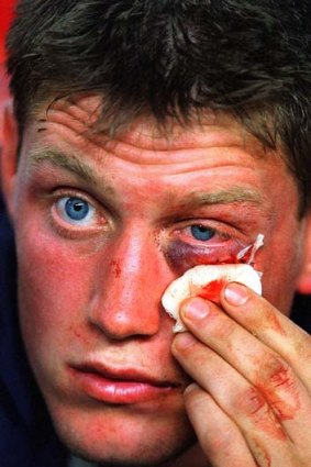 War-wound ... Ronan O'Gara of the British Lions looks on from the bench after receiving eight stitches.