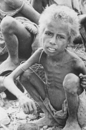 A Timorese child in the 1977-79 famine.