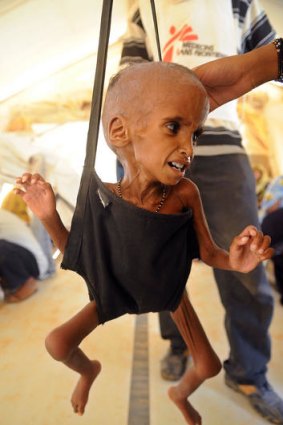 Fighting for life ... a malnurished Malian refugee child is weighed at the Medecins sans Frontieres medical centre of the M'bere refugee camp.