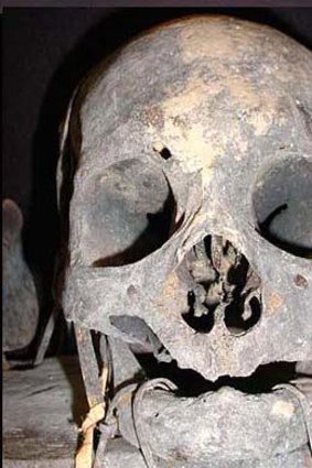 Ancient skull ... a trophy to Filipino head hunters.