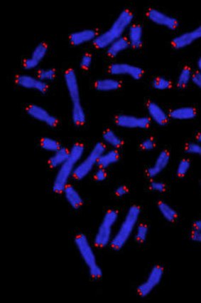 Chromosomes from a human cancer cell  fibrosarcoma. <i>Photo: Axel Neumann of the Children's Medical Research Institute</i>