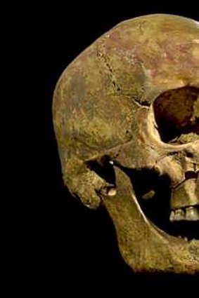 The skull of Richard III found at the Grey Friars Church excavation site in Leicester.