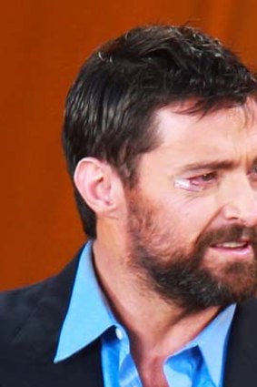 After the stunt: Mr Jackman's facial laceration.