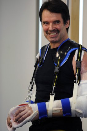Karl Merk with his new arms, which are supported by a harness while the healing continues.