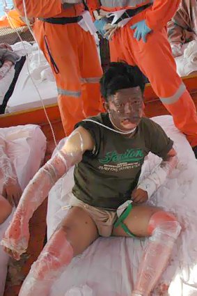 Asylum seekers are treated for injuries from the explosion.