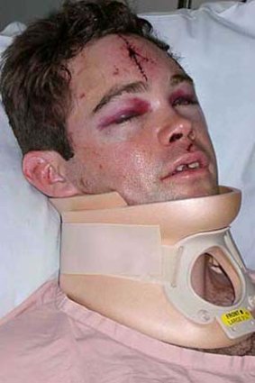 Justin Crosby: broke his neck when he fell at Sydney pub Jacksons on George.