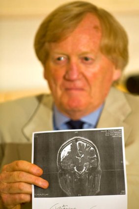 Ron Walker with an image from his brain scan.