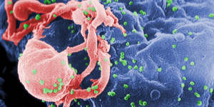 A scanning electron micrograph of multiple round bumps of the HIV-1 virus on a cell surface.
