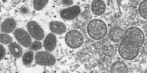 An electron microscope image shows mature,oval-shaped monkeypox virions.