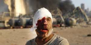An injured man walks at the explosion scene that hit the seaport,in Beirut.