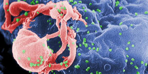 A scanning electron micrograph of multiple round bumps of the HIV-1 virus on a cell’s surface.