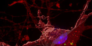 Researchers have identified how tau protein spreads around the brain to contribute to Alzheimer’s disease.