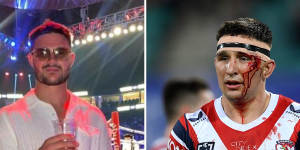 World Cup investigating alleged Manchester fight involving Roosters star Victor Radley