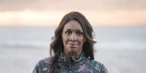 Turia Pitt:“I was suddenly overwhelmed by feelings of love and gratitude for you.”