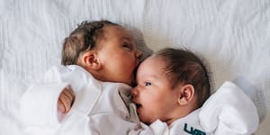 Woman with two wombs gives birth to twins on different days