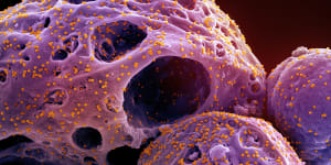 This colourised electron microscope image made available by the National Institute of Allergy and Infectious Diseases shows cells,indicated in purple,infected with COVID-19.