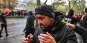 A man is seen with a wound to his forehead on Monday