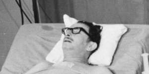 Haskell Karp,recipient of the first artificial heart implant,the Liotta-Cooley heart,recovering from surgery in 1969. Previously,the device had only been tested on seven animals. Karp survived 64 hours until a human heart transplant became available,but died 32 hours later.