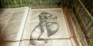 The anatomy of the human gravid uterus exhibited in figures,William Hunter,1815,is on display in the State LIbrary of NSW’s new exhibition Kill or Cure.