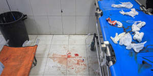 Blood stains on the floor and used bandages on a gurney after the treatment of injured Palestinians at the Nasser Medical hospital,in southern Gaza.