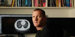Professor Stuart Grieve,with a lung CT scan showing moderate COVID-19. He's the co-creator of a tool that will train doctors in diagnosing the disease from scans.
