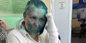 Prominent Russian journalist brutally beaten by masked attackers