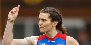 Kirsten McLeod has spoken about losing her vision while driving on a freeway after concussion sustained during a VFLW game. 