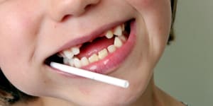 Most families eligible for child dental rebate refuse to take bite