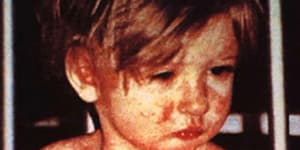 Measles will be back after 22 million babies miss their shots:WHO