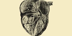 There were 125 heart transplants in Australia in 2025.