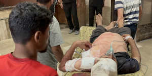 An injured Palestinian,lying on a stretcher,is brought to a hospital after Israeli airstrike on a tent encampment of displaced Palestinians in the Al-Mawasi area of Khan Yunis.