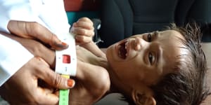 UN chief blasts ‘disappointing’ Yemen pledge by rich countries as children starve