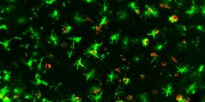 A COVID-19 infected mouse brain showing ‘angry’ microglia in green and SARS-CoV-2 in red.