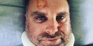 Former cricketer Matthew Hayden injured while surfing off Stradbroke