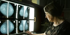 Breast cancer screening should remain a high priority